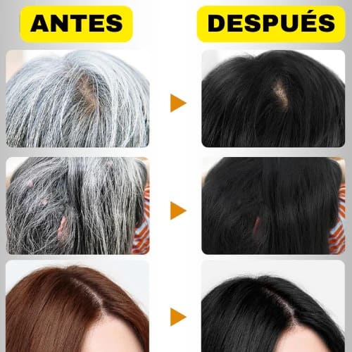 Shampoo AntiCanas - Disaar: Desaparece las canas en Minutos 😱